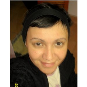 alopecia-areata-23 alopecia-areata-23